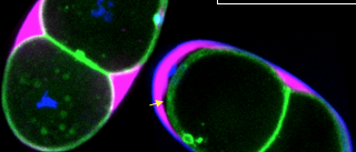 seipin mutant caused eggshell defects.