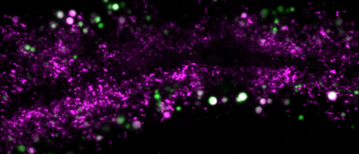 The perisome marker DAAO-1::mScarlet expresses in intestine