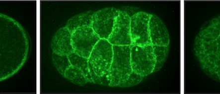 GFP::PEZO-1 expresses at the plasma membrane