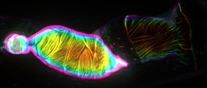 F-actin in the occupied spermathecal cells